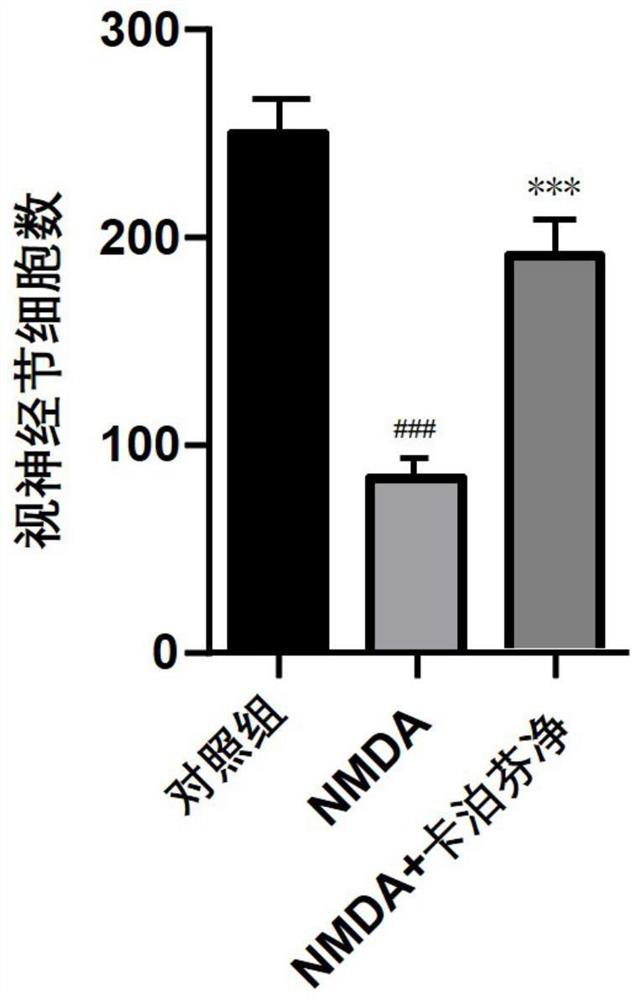 Application of caspofungin in preparation of neuroprotective drugs