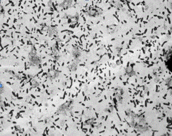 Fluoroglycofen-ethyl degradation pseudomonas YS-03 and application thereof