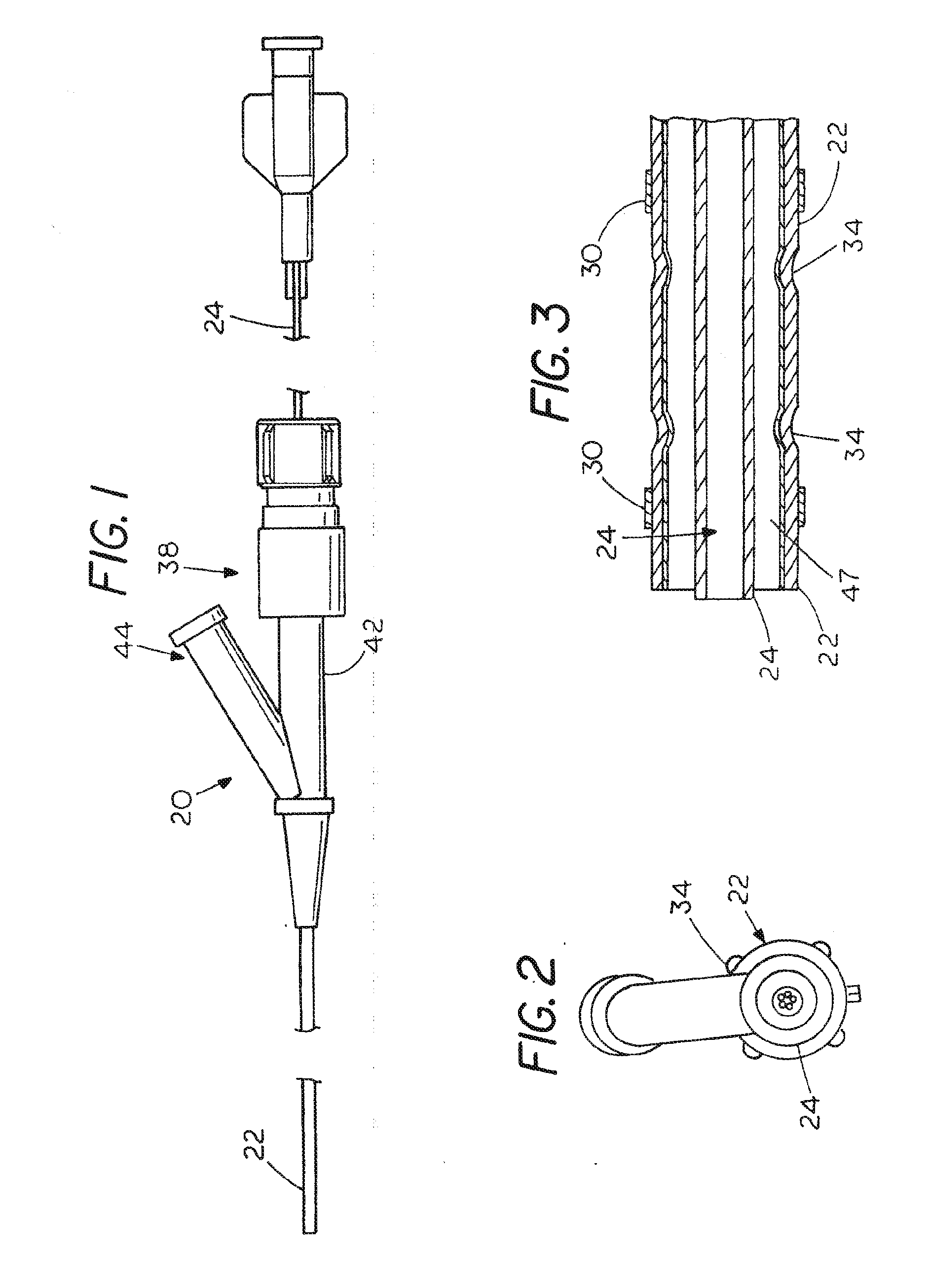 Extradural Infusion Suction System and Method to Drain Fluid Collection in the Extradural Space of Spinal Cord