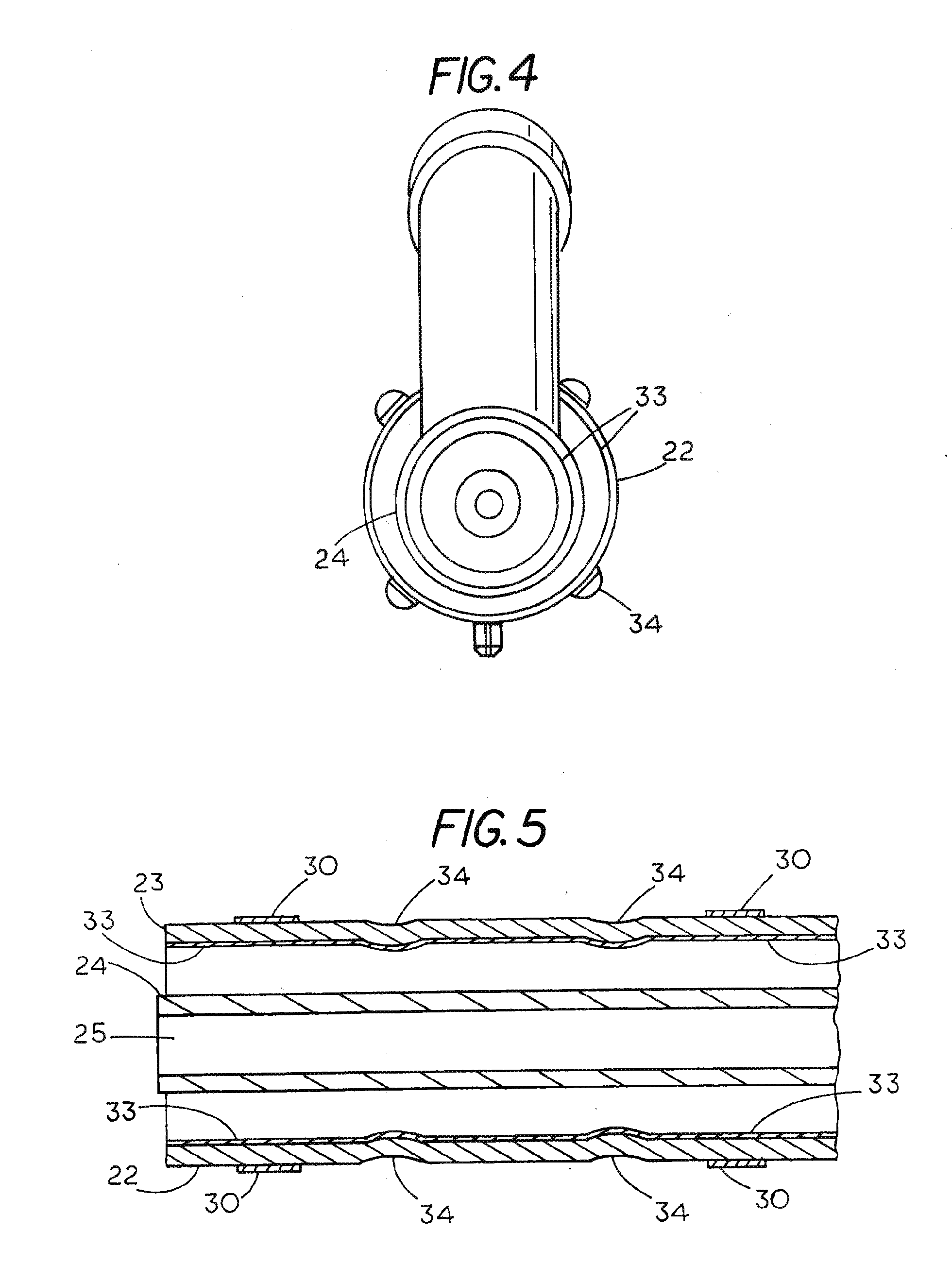 Extradural Infusion Suction System and Method to Drain Fluid Collection in the Extradural Space of Spinal Cord