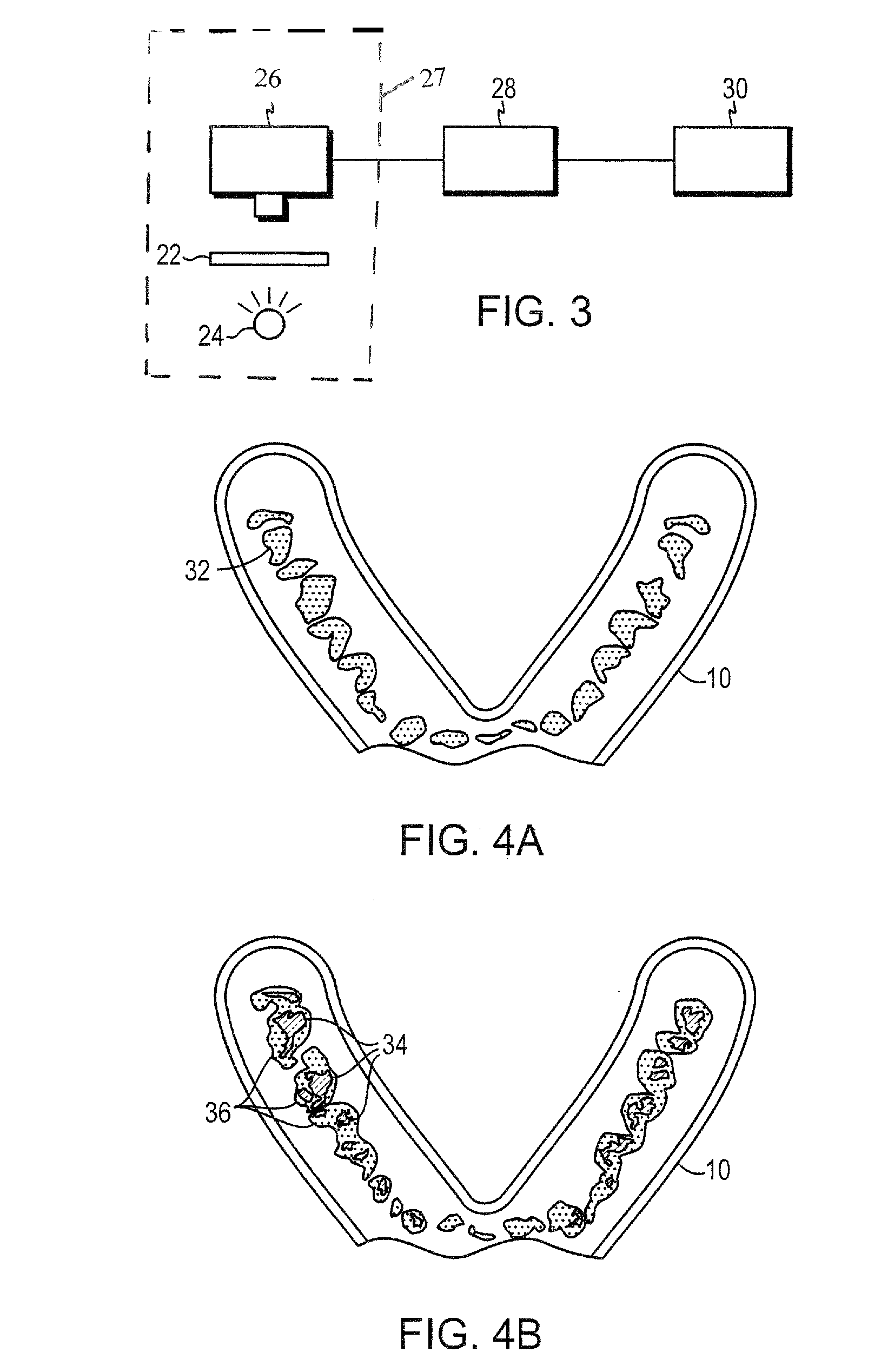 Method for occlusal position measurement and recording