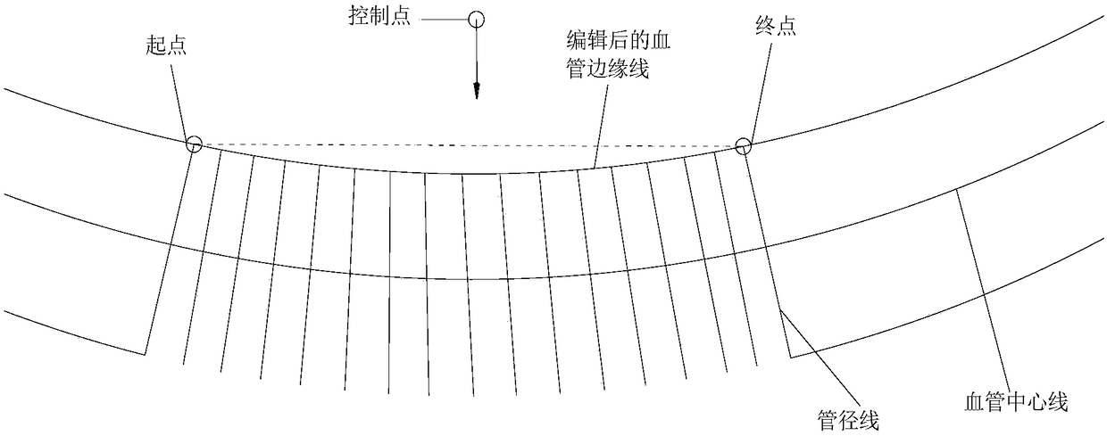 Editing method and device of retinal vessel edge line