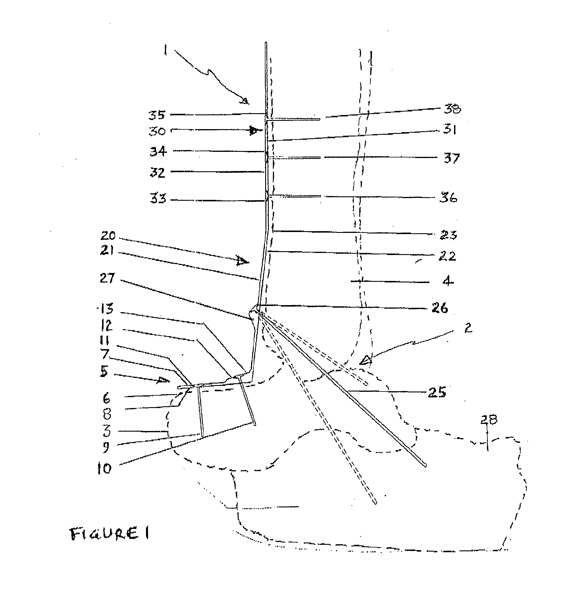 Ankle Fusion Plate