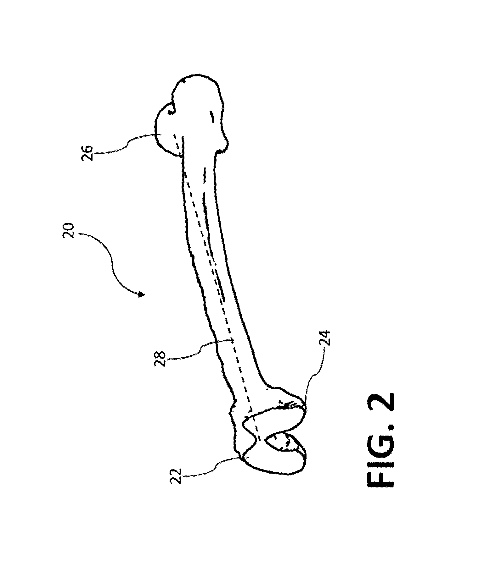 Devices and methods for knee arthroplasty