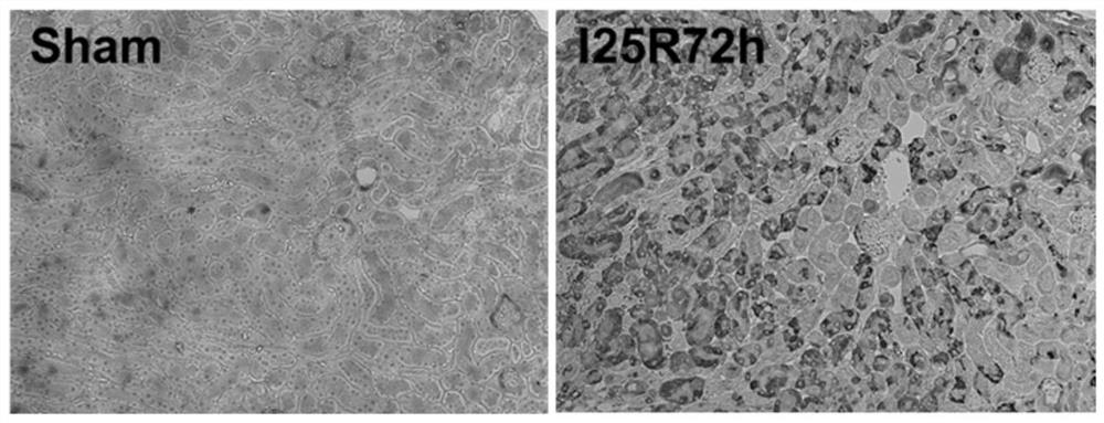 Application of cryab in the detection of acute kidney injury and its detection kit