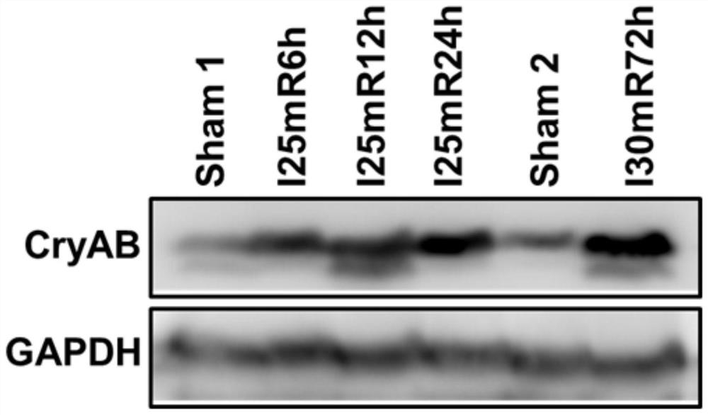 Application of cryab in the detection of acute kidney injury and its detection kit