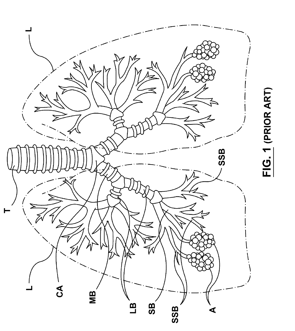 Methods, apparatuses, and systems for the treatment of pulmonary disorders