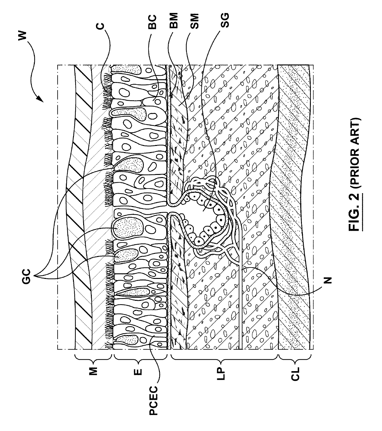 Methods, apparatuses, and systems for the treatment of pulmonary disorders