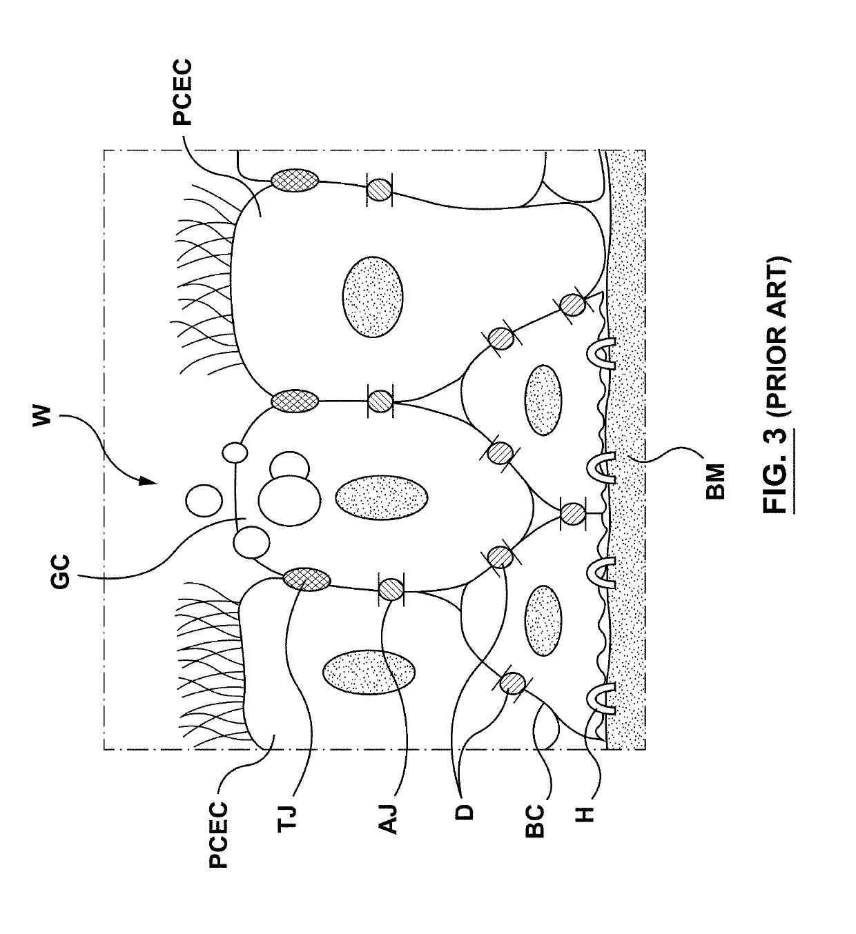 Methods, apparatuses, and systems for the treatment of pulmonary disorders