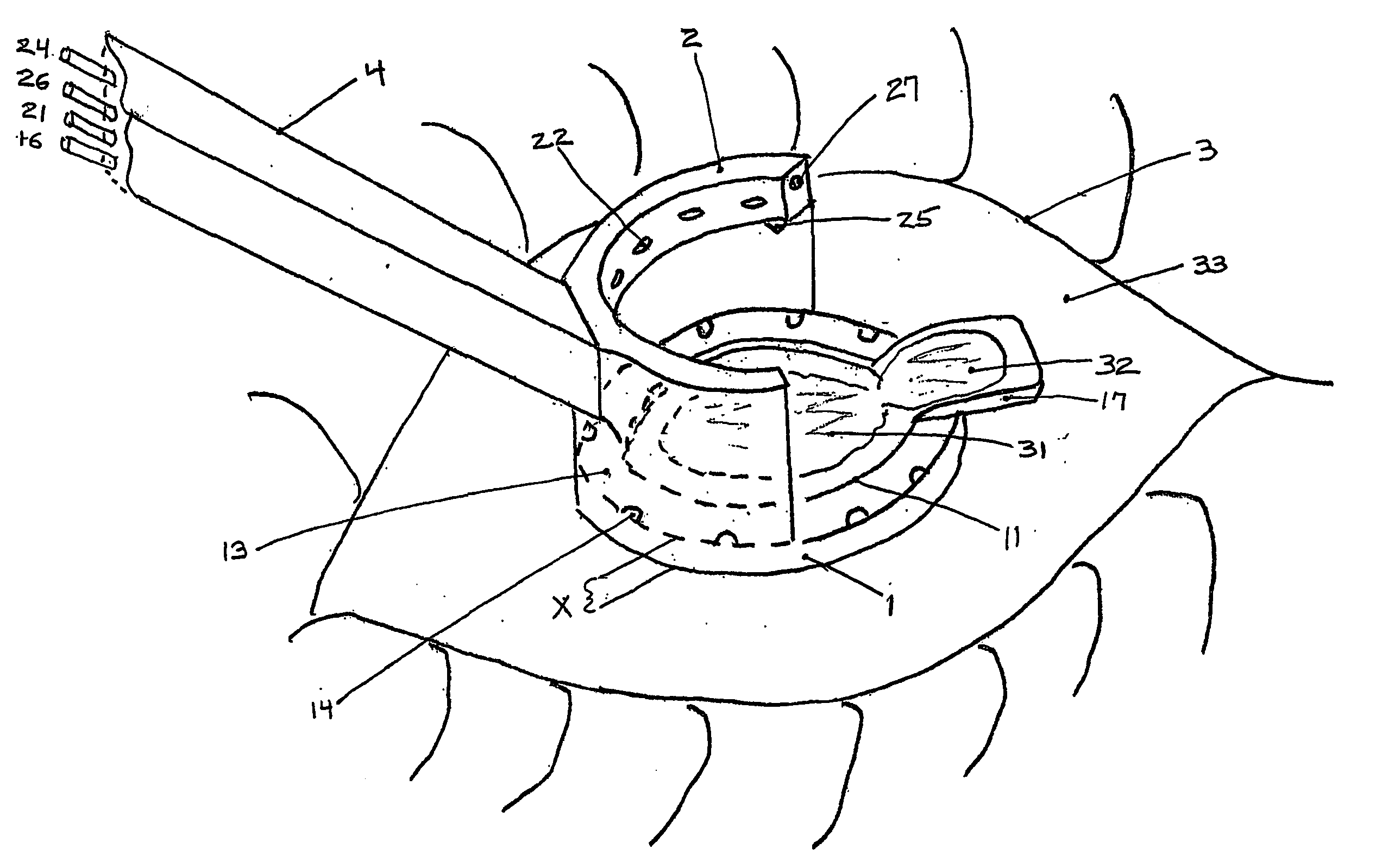 Multi-function surgical instrument for facilitating opthalmic laser surgery