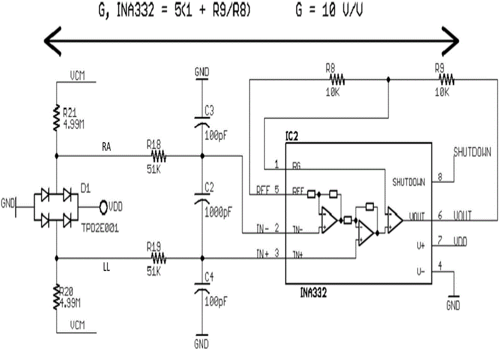 Wearable electrocardiogram monitoring system