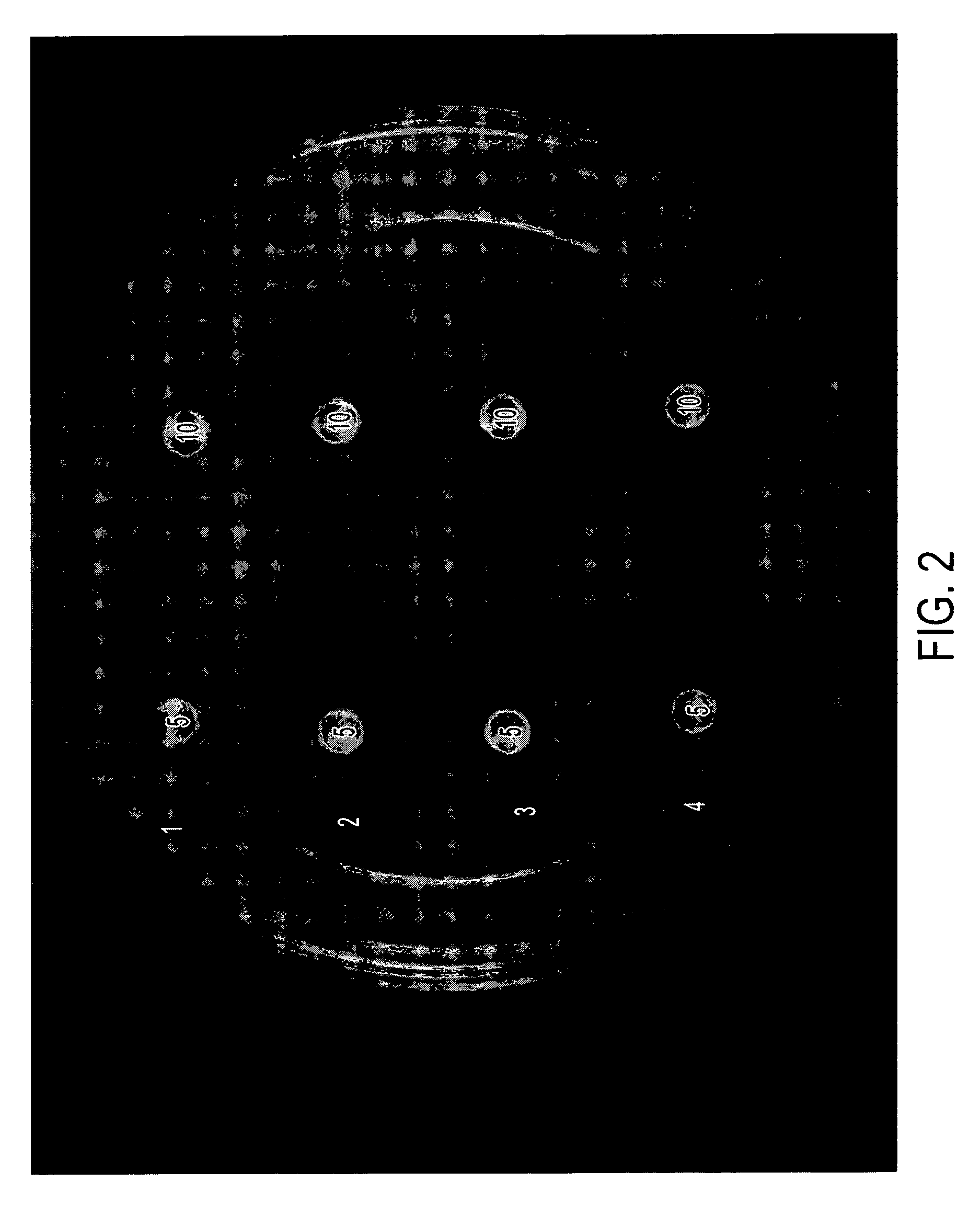 Method of treatment of otitis externa