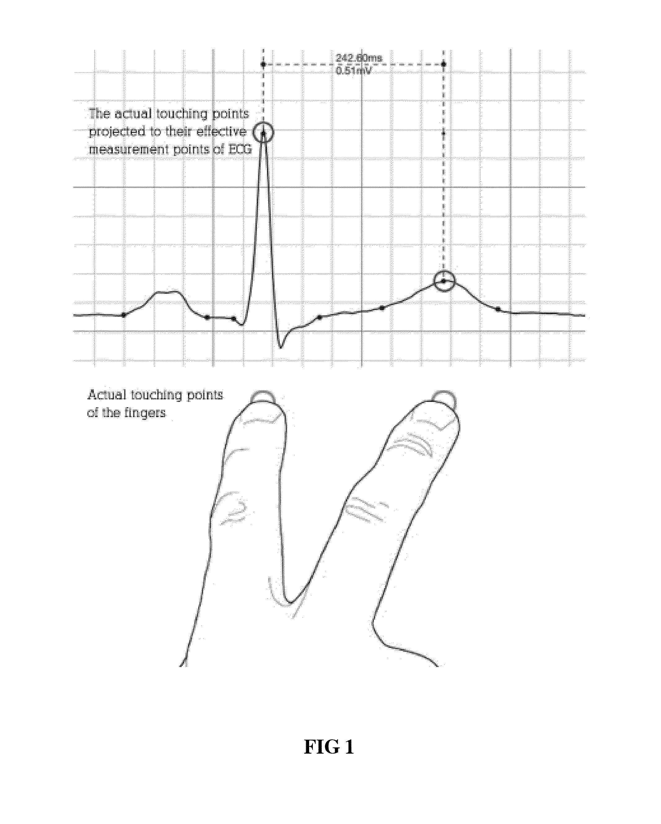 Multi-touch approach for ECG measurement