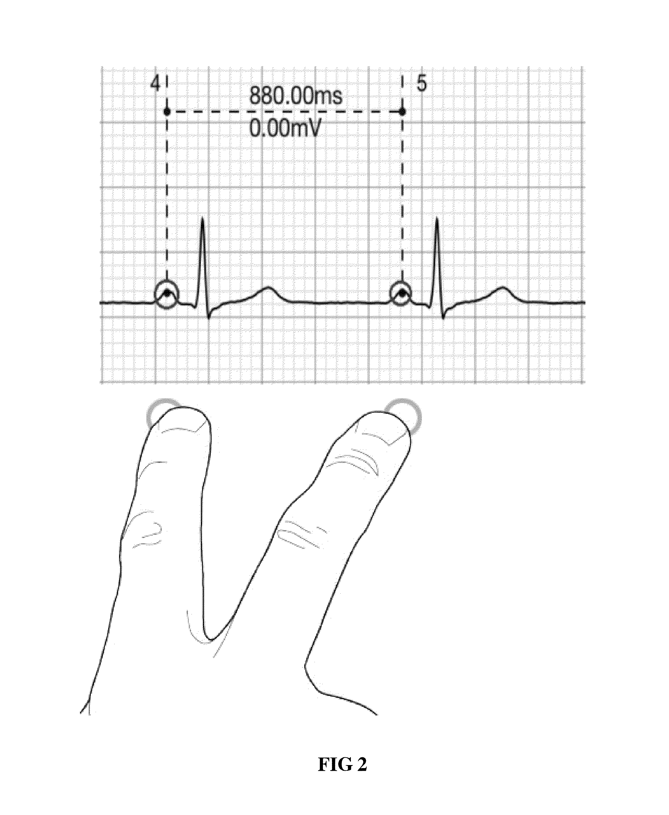 Multi-touch approach for ECG measurement