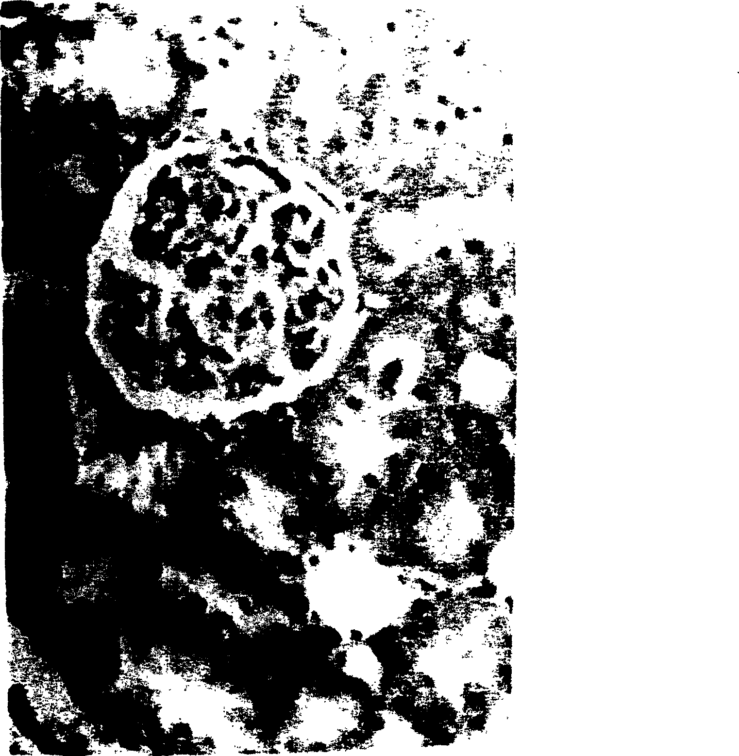 Pharmaceutical composition containing valibose, its preparation method and application