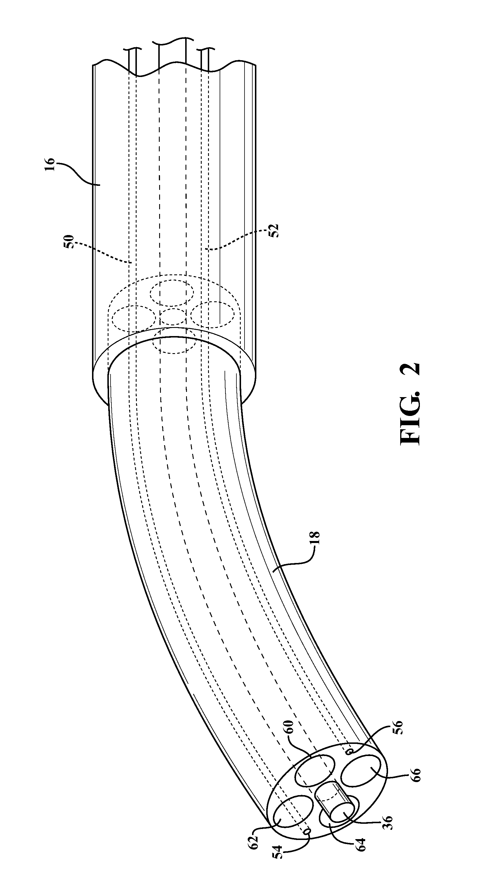 Method and apparatus for cold plasma treatment of internal organs