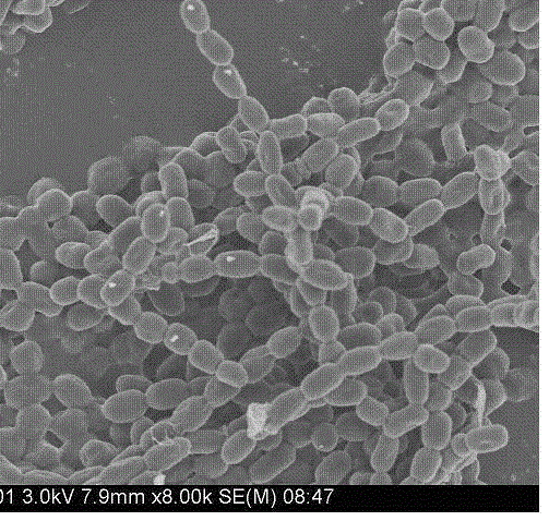 Ocean actinomycetes strain producing plasmin, application and plasmin prepared from same and application of plasmin