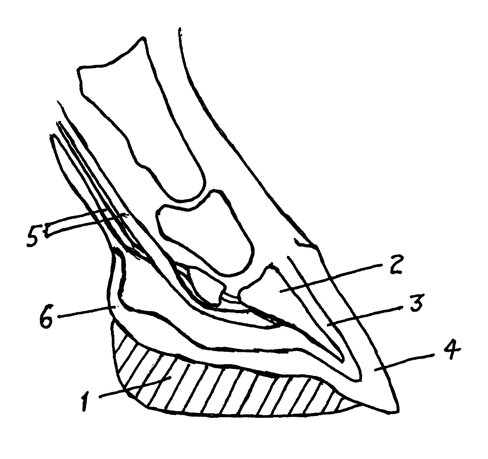 Method of treatment for founder and laminitis in the equine hoof