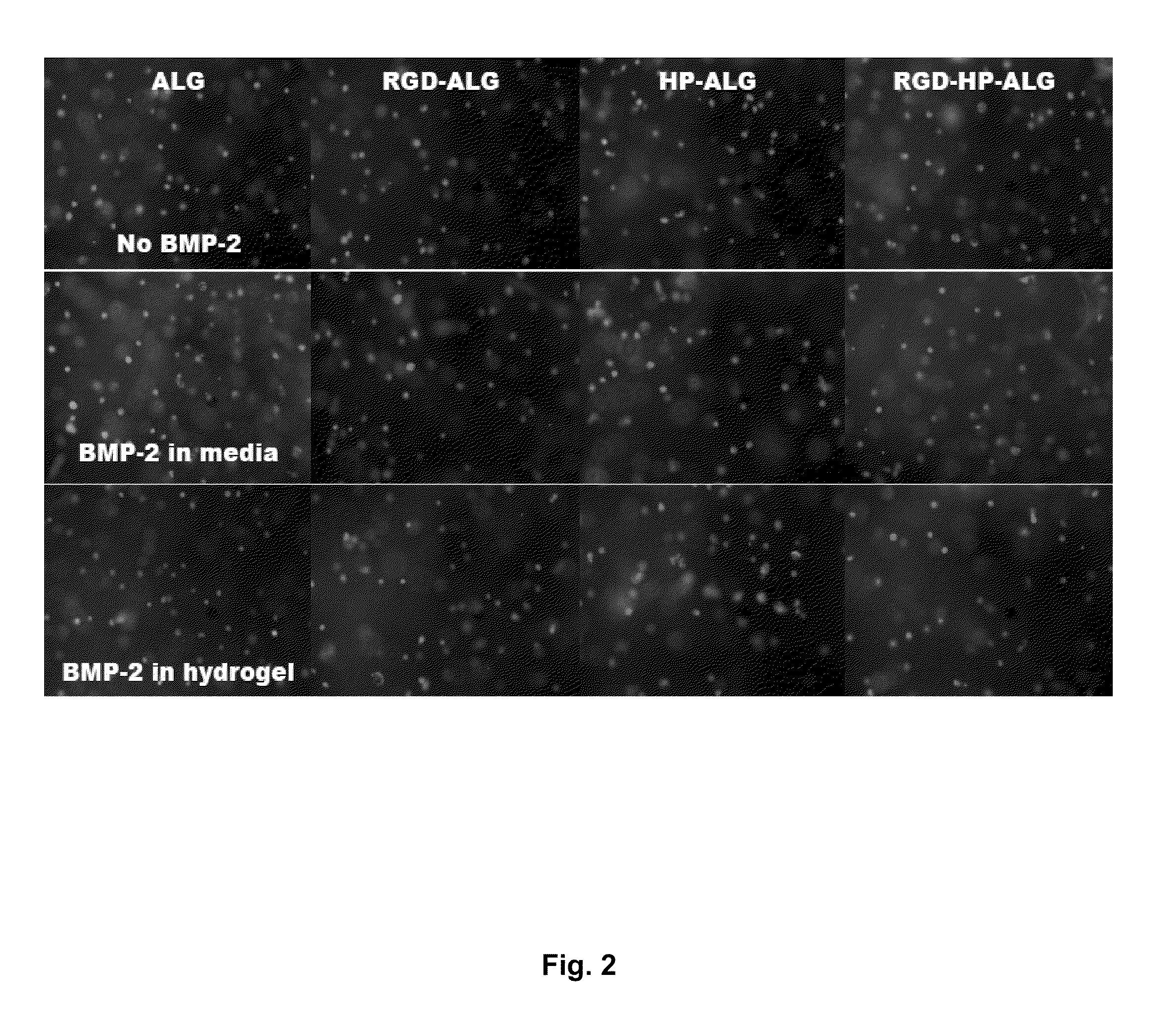 Photocrosslinked biodegradable hydrogel