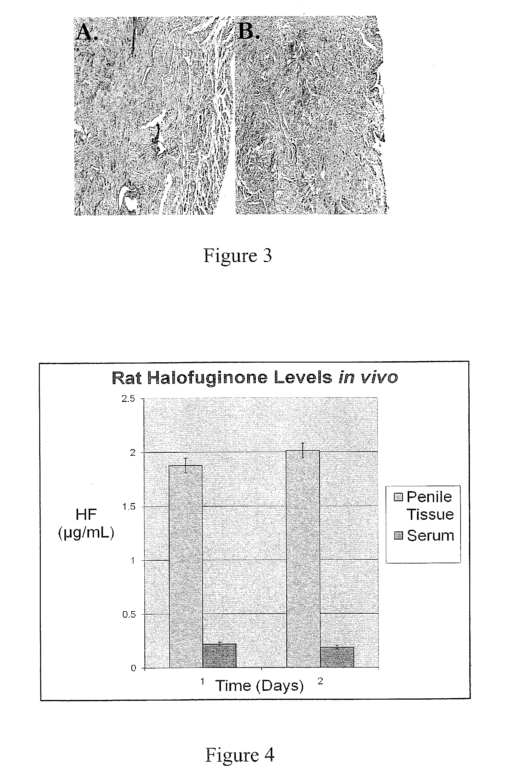 Urologic devices incorporating collagen inhibitors