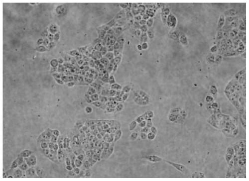 Preparation for inhibiting candida albicans