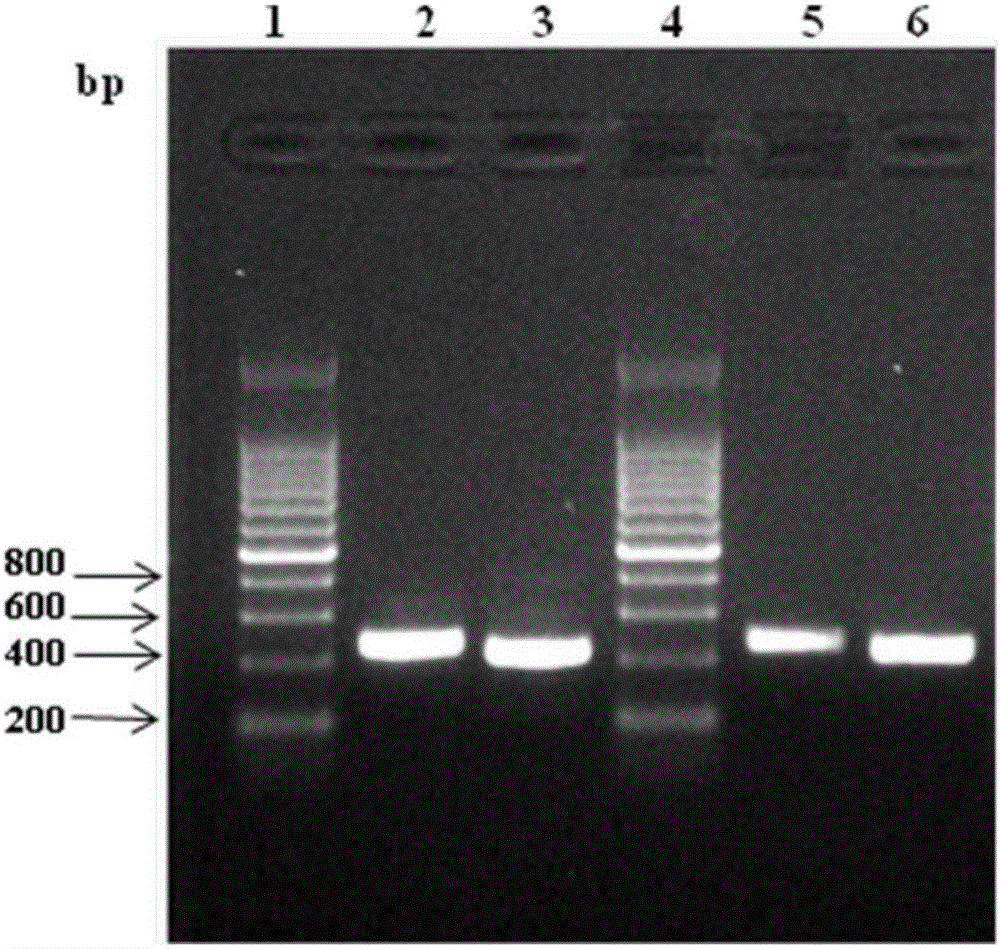 Fluorogenic quantitative detection test card for human C-reactive protein