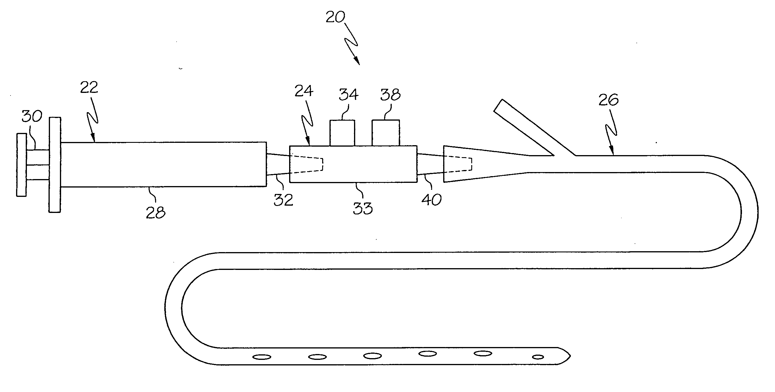 Gastrointestinal insufflation device and method