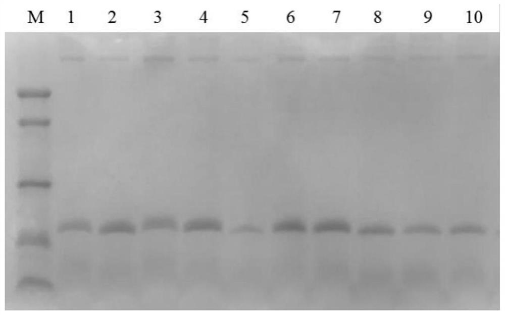 Genetically engineered bacterium for expressing insulin precursor, and preparation method and application of genetically engineered bacterium