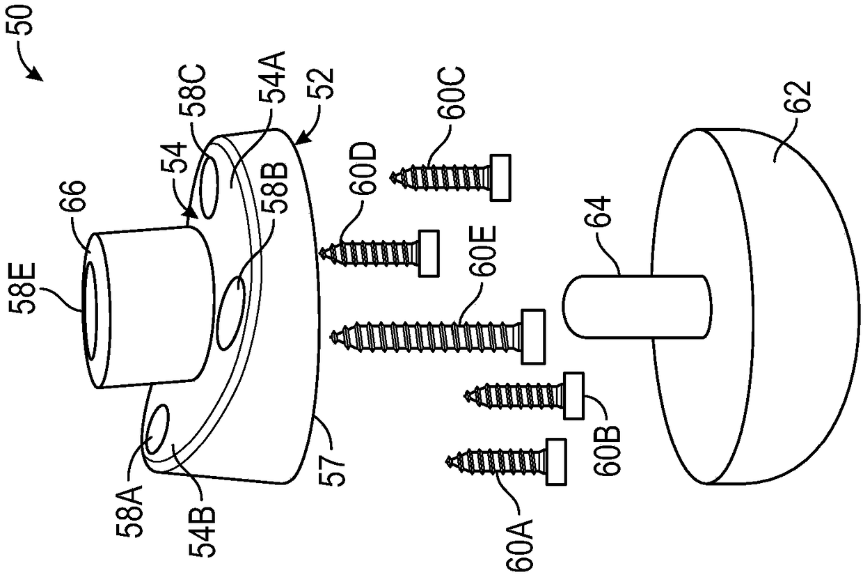 Patient-specific augmented glenoid systems