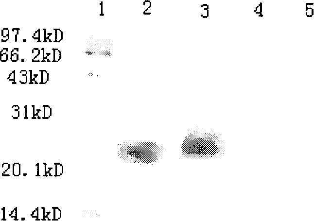 Application of human sDR5 protein as medicine to treat virus hepatitis B