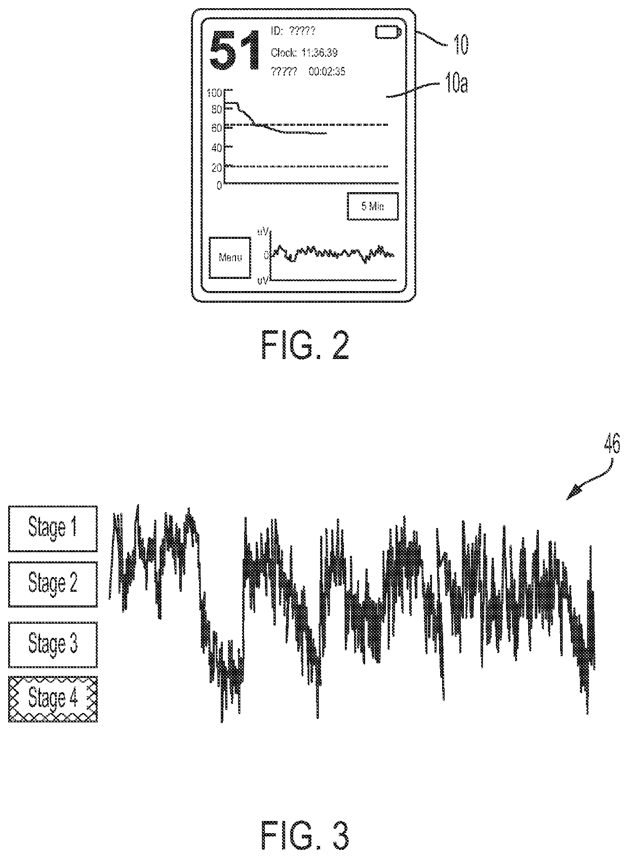 Systems and methods for improving patient health