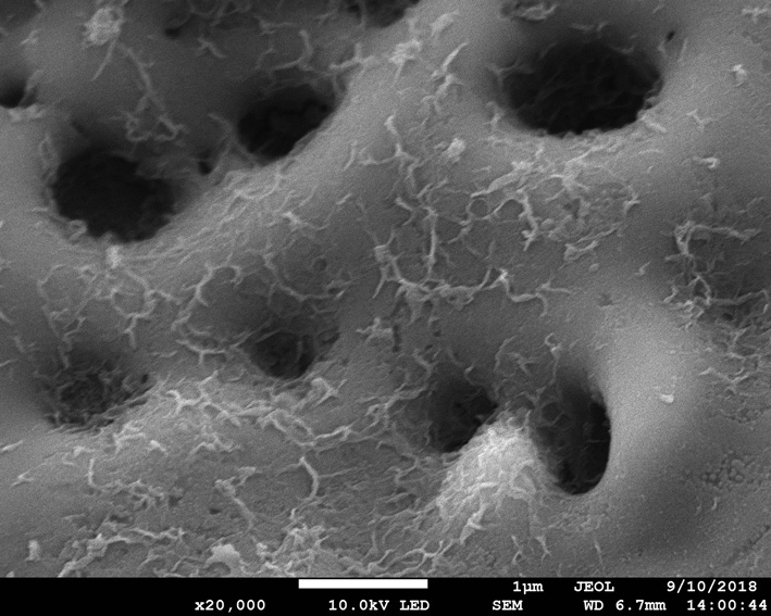 Degradable magnesium alloy bone nail with scaly bone-like nanostructure coating and preparation method thereof