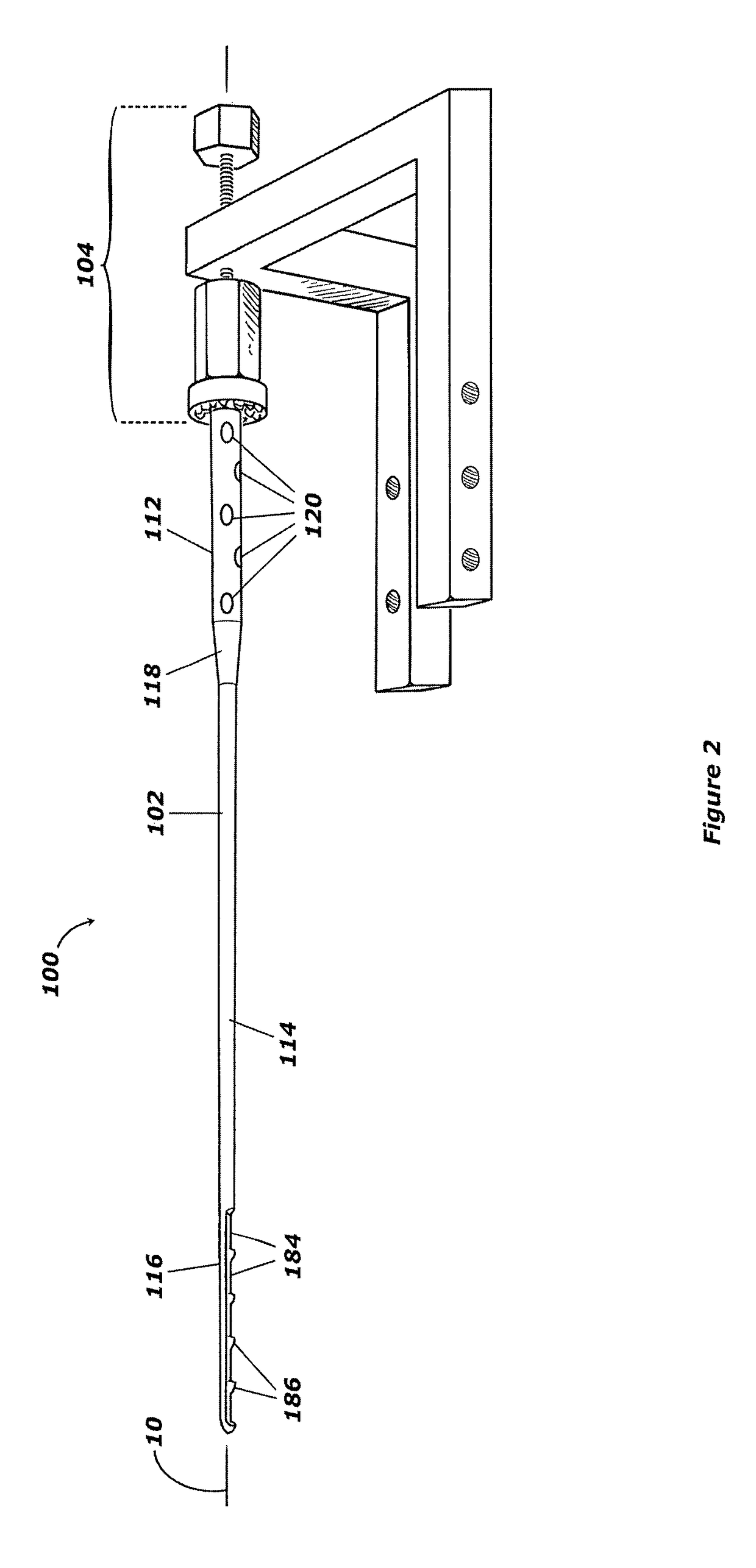 Intramedullary compression rod