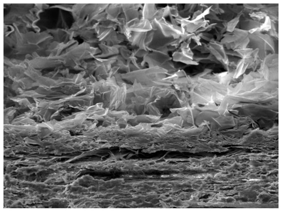 Degradable artificial dura mater with double-layer structure and preparation method of degradable artificial dura mater