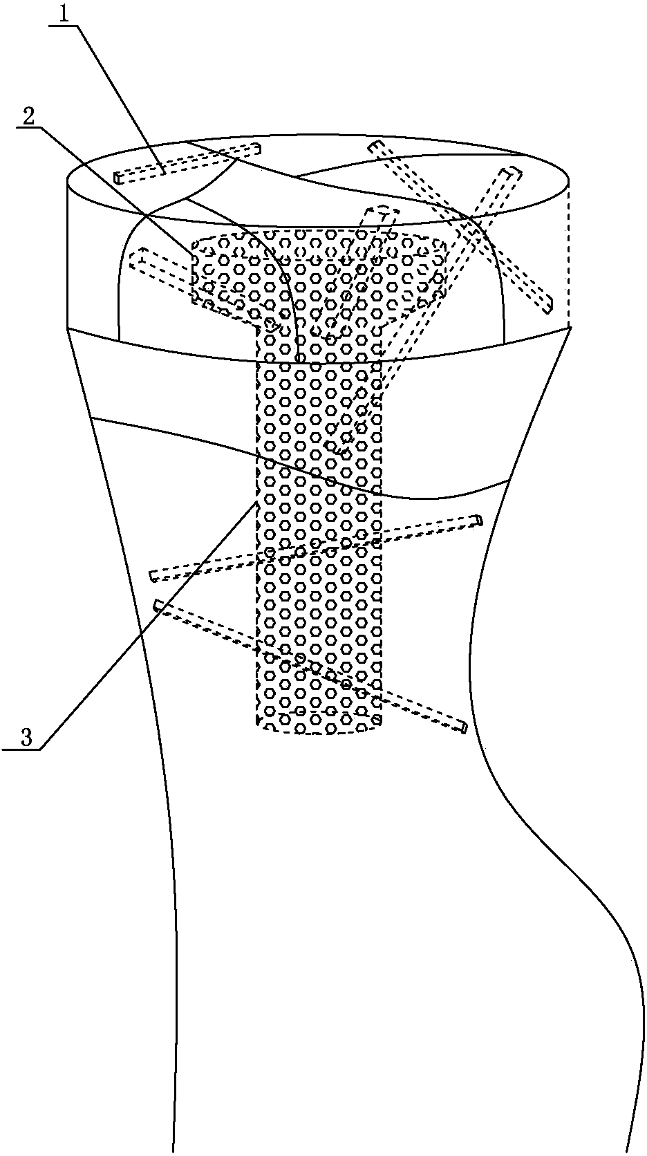 Radius head comminuted fracture in-pile fixing device and method