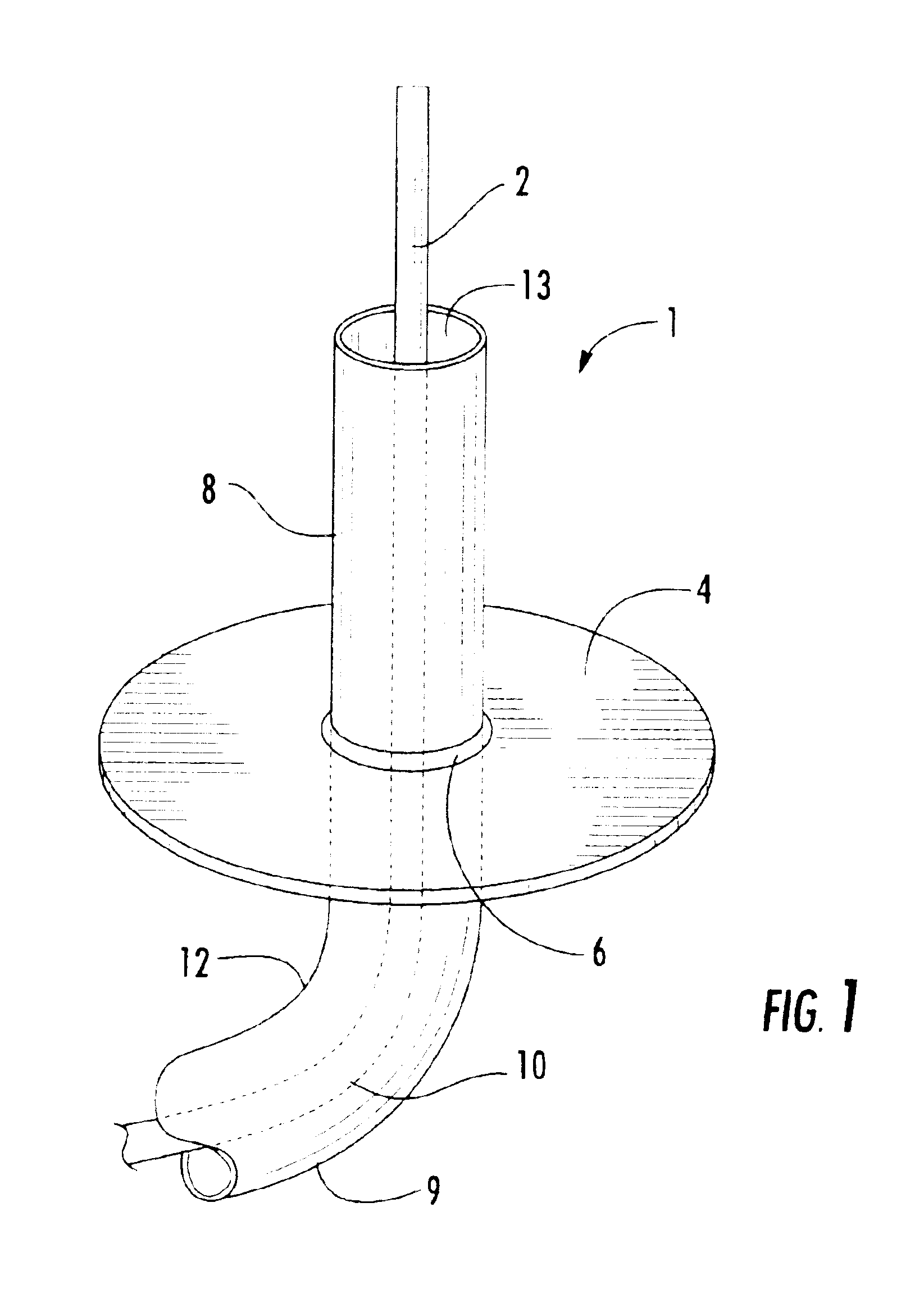 Dual band sleeve antenna