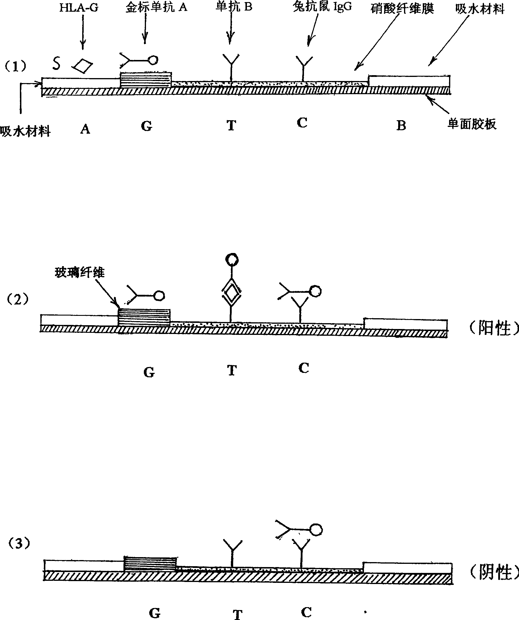 Simple method for detecting HLA-G and antibody thereof by gold-labeled immunoassay