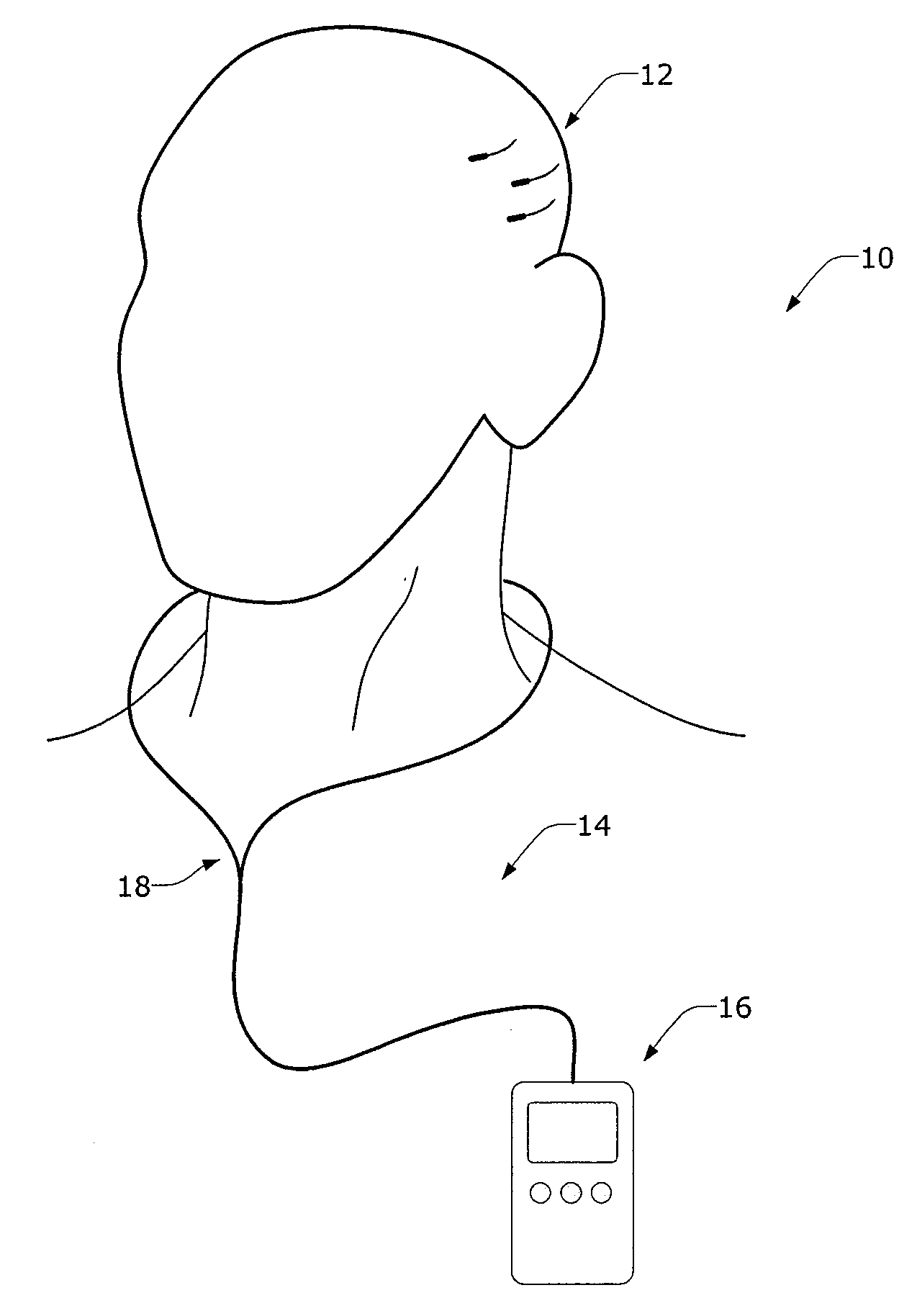 Minimally Invasive Monitoring Methods