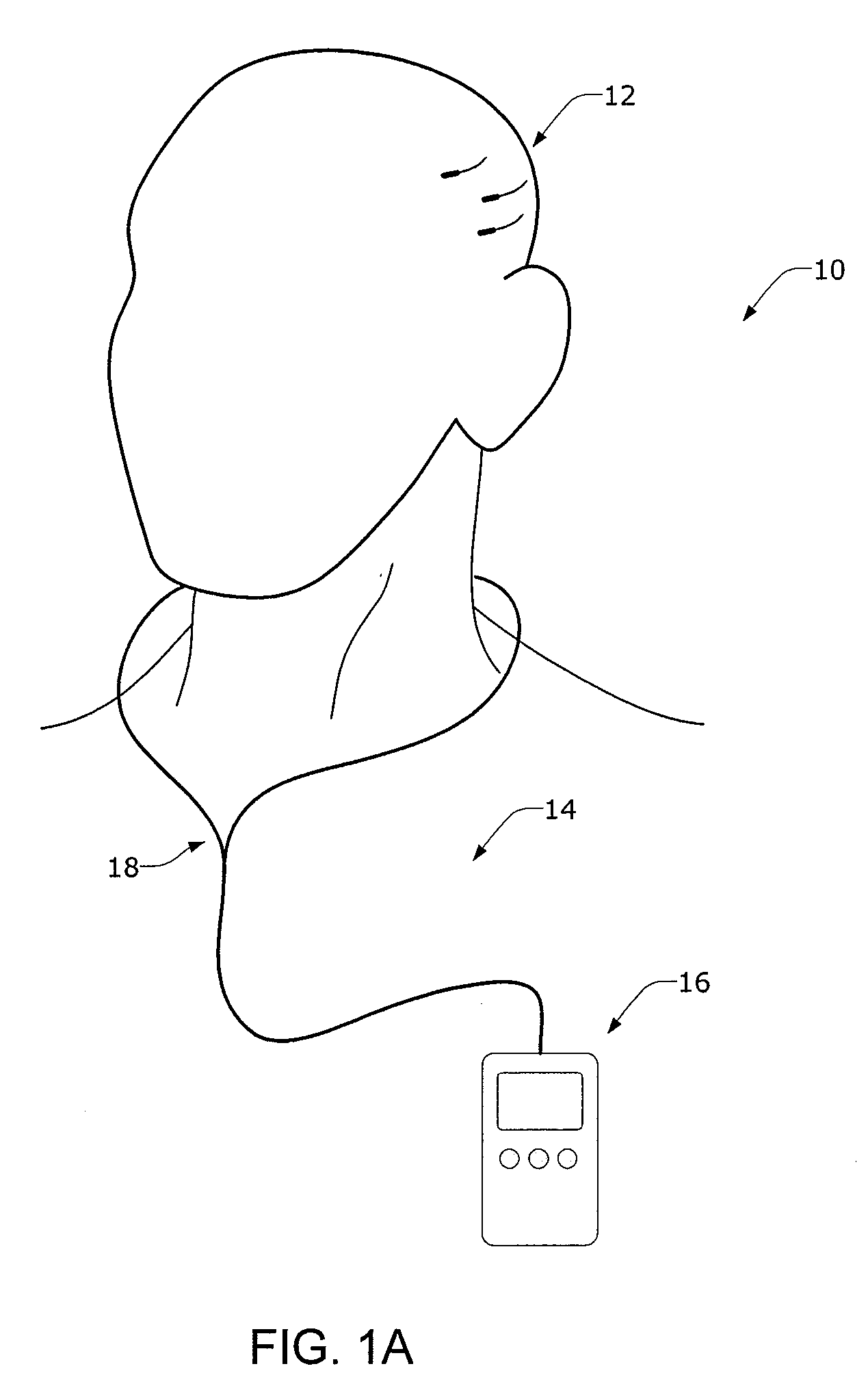 Minimally Invasive Monitoring Methods