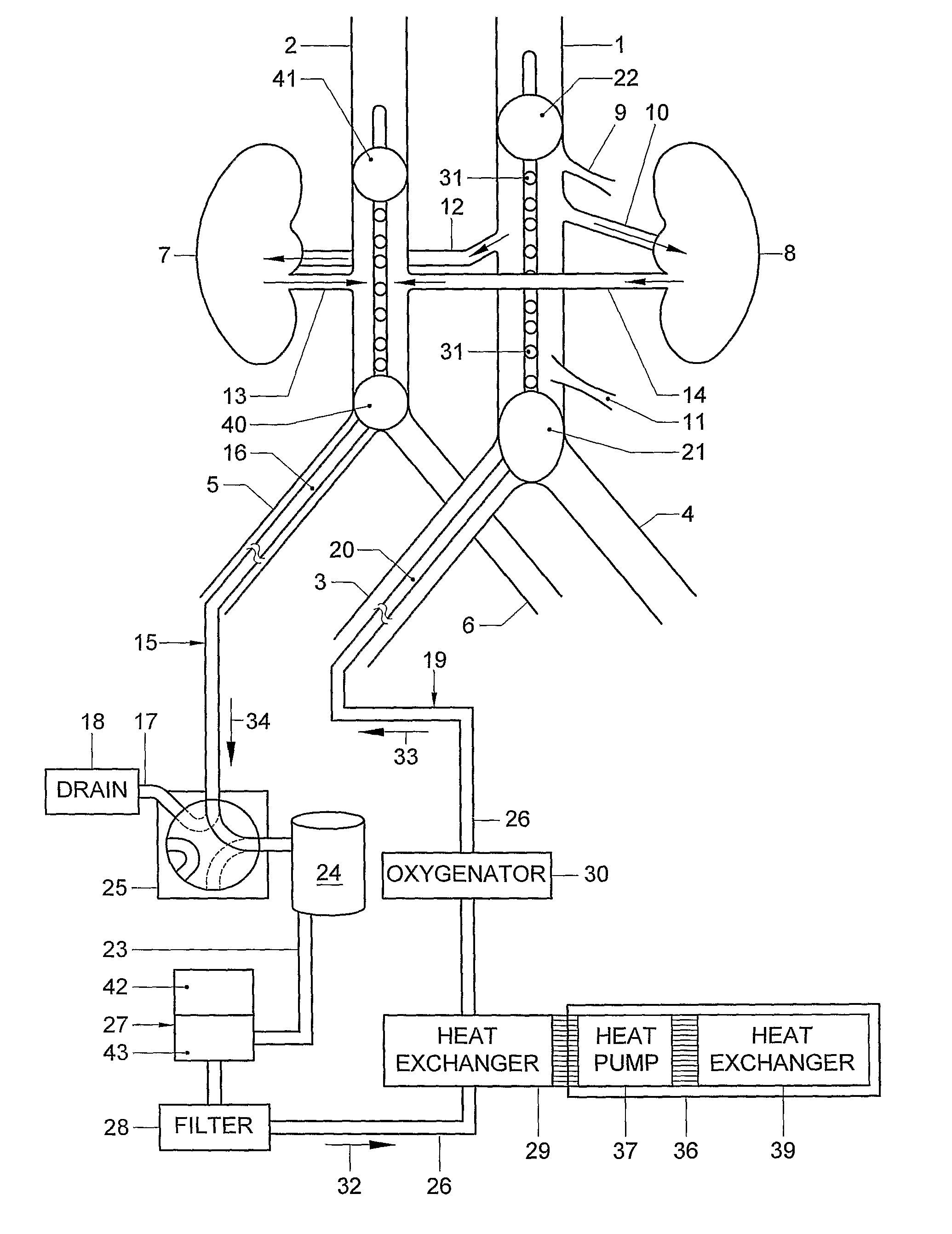 Method and a system for prolongation of the viability of a donor organ