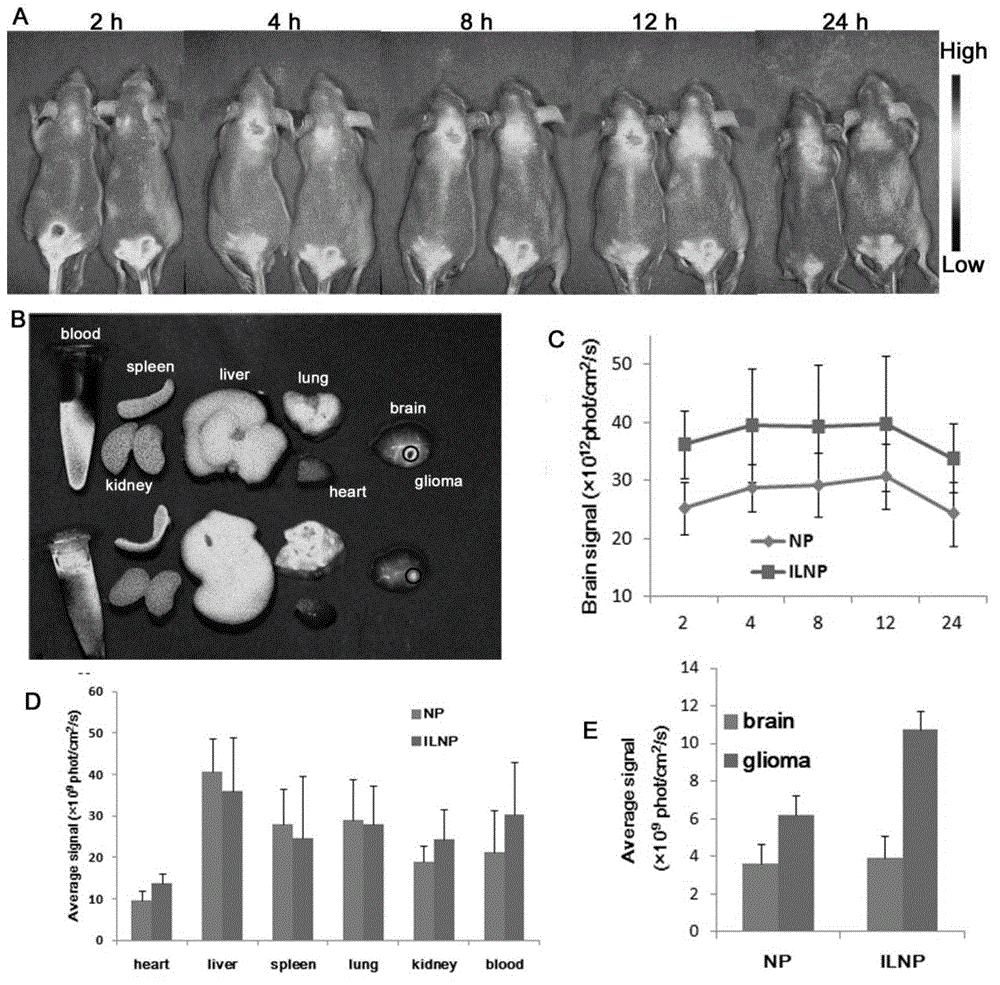 A targeted nano drug delivery system for glioma