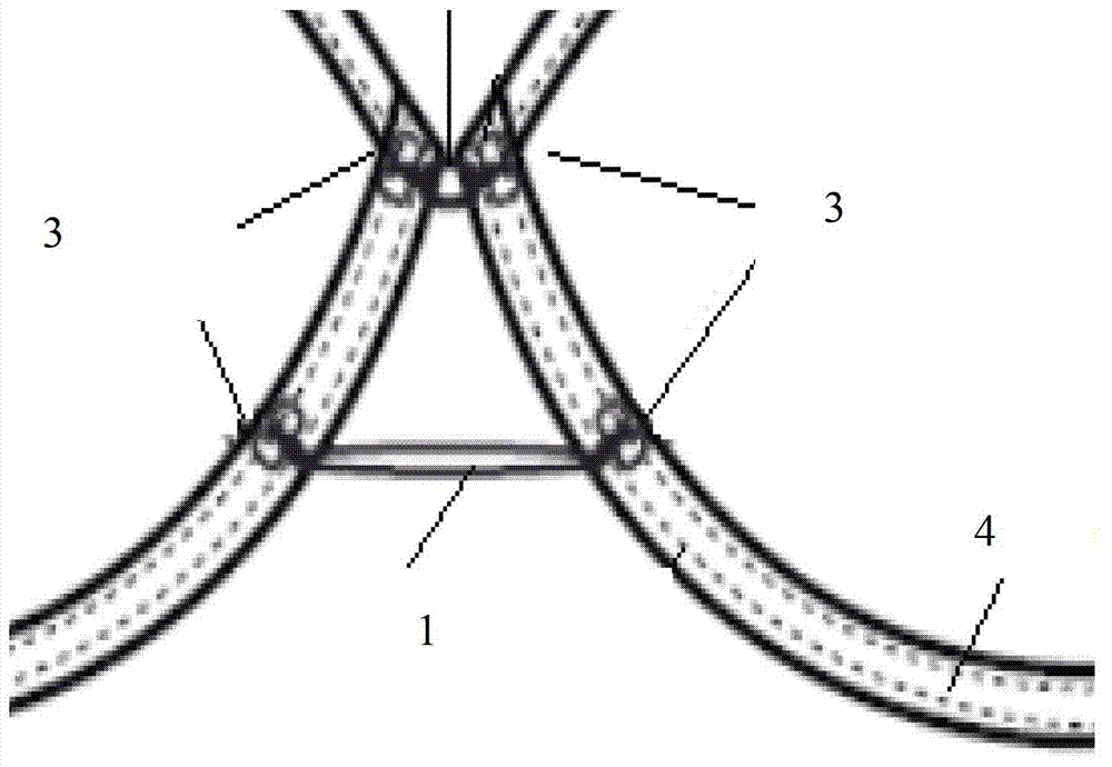 An interchangeable cup bridging system