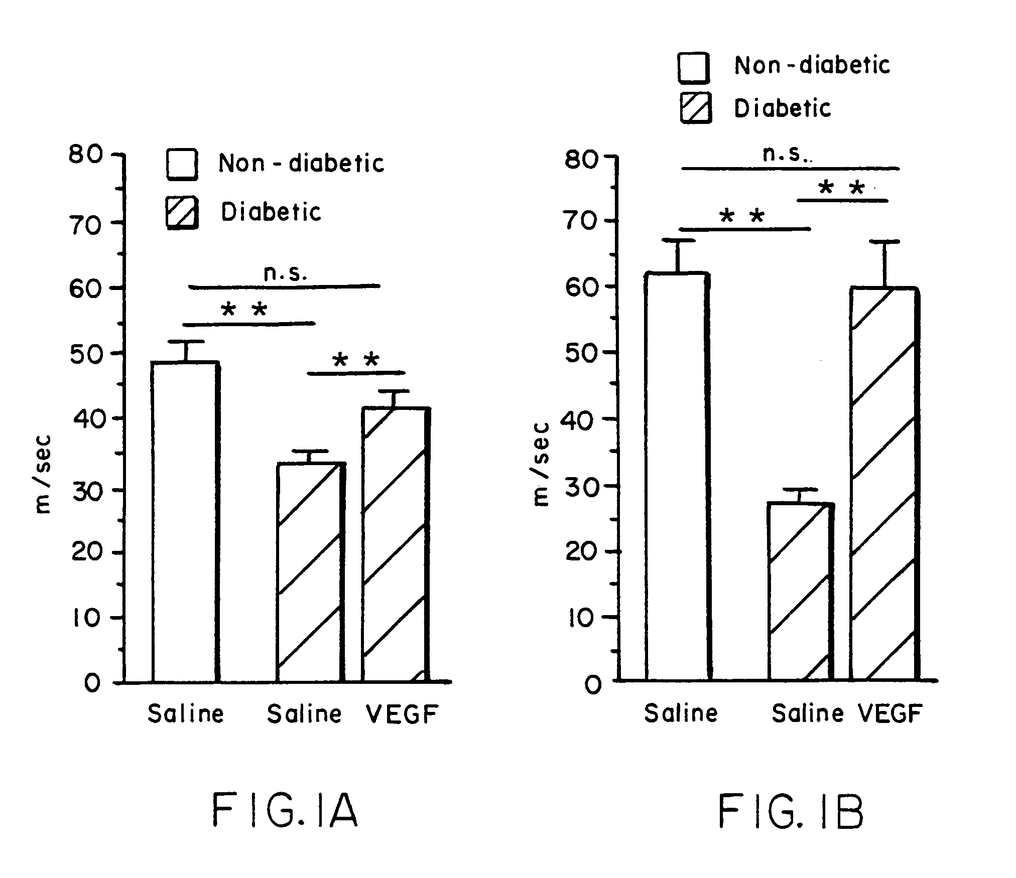 Angiogenic growth factors for treatment of peripheral neuropathy