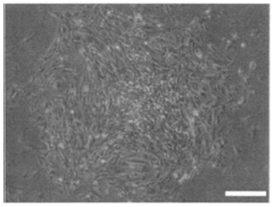 Hair restoring liquid containing dermal papilla cell derived exosome and collagen and preparation method thereof