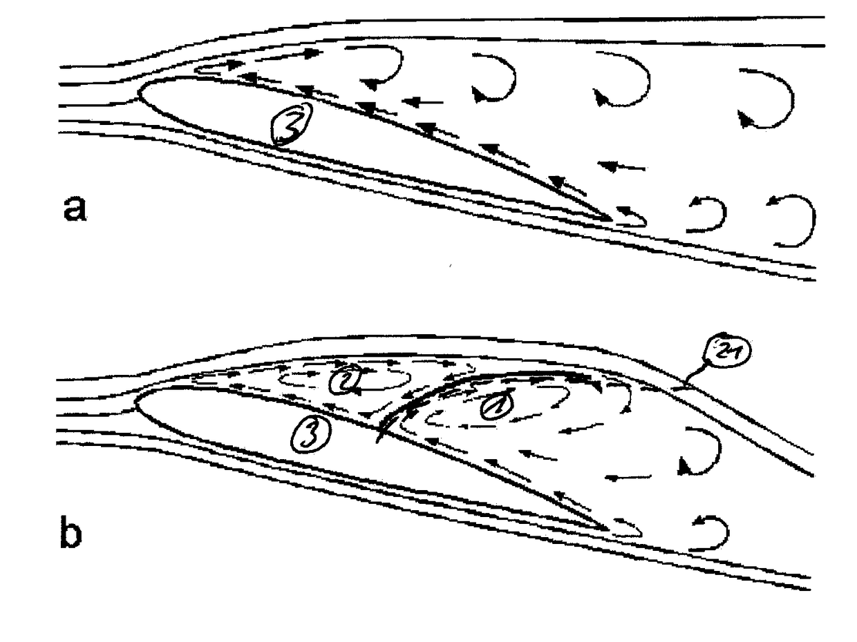 Multi-functional flap used as a back-flow flap