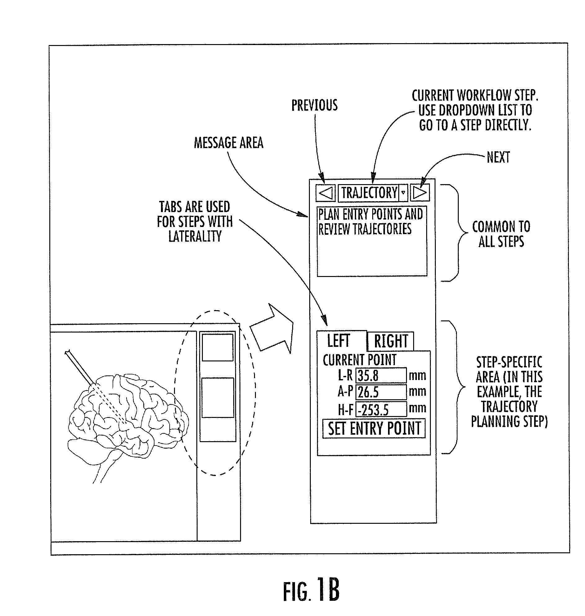 MRI-guided medical interventional systems and methods