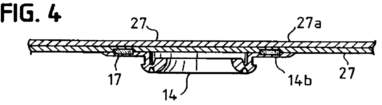 In-line method of manufacture of ostomy appliance faceplate