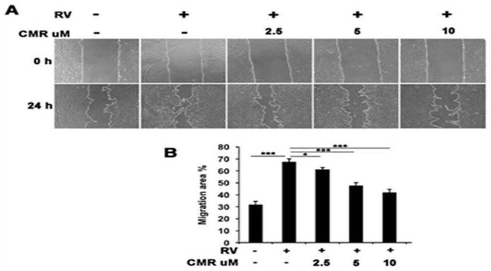 Applications of Chalcomoracin and homologues thereof in preparation of drugs for treatment of proliferative vitreoretinopathy