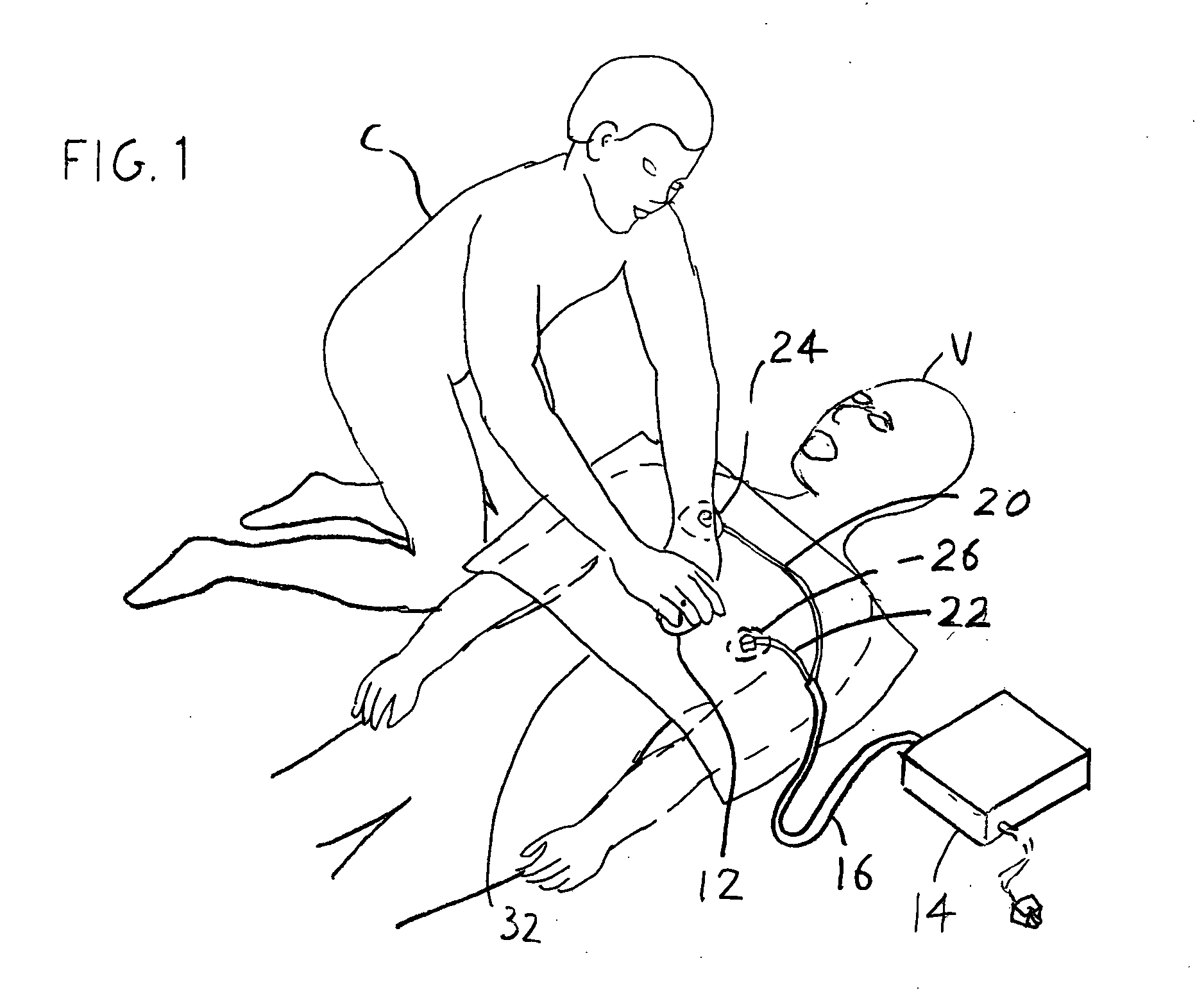 Enhanced rhythm identification in compression corrupted ECG