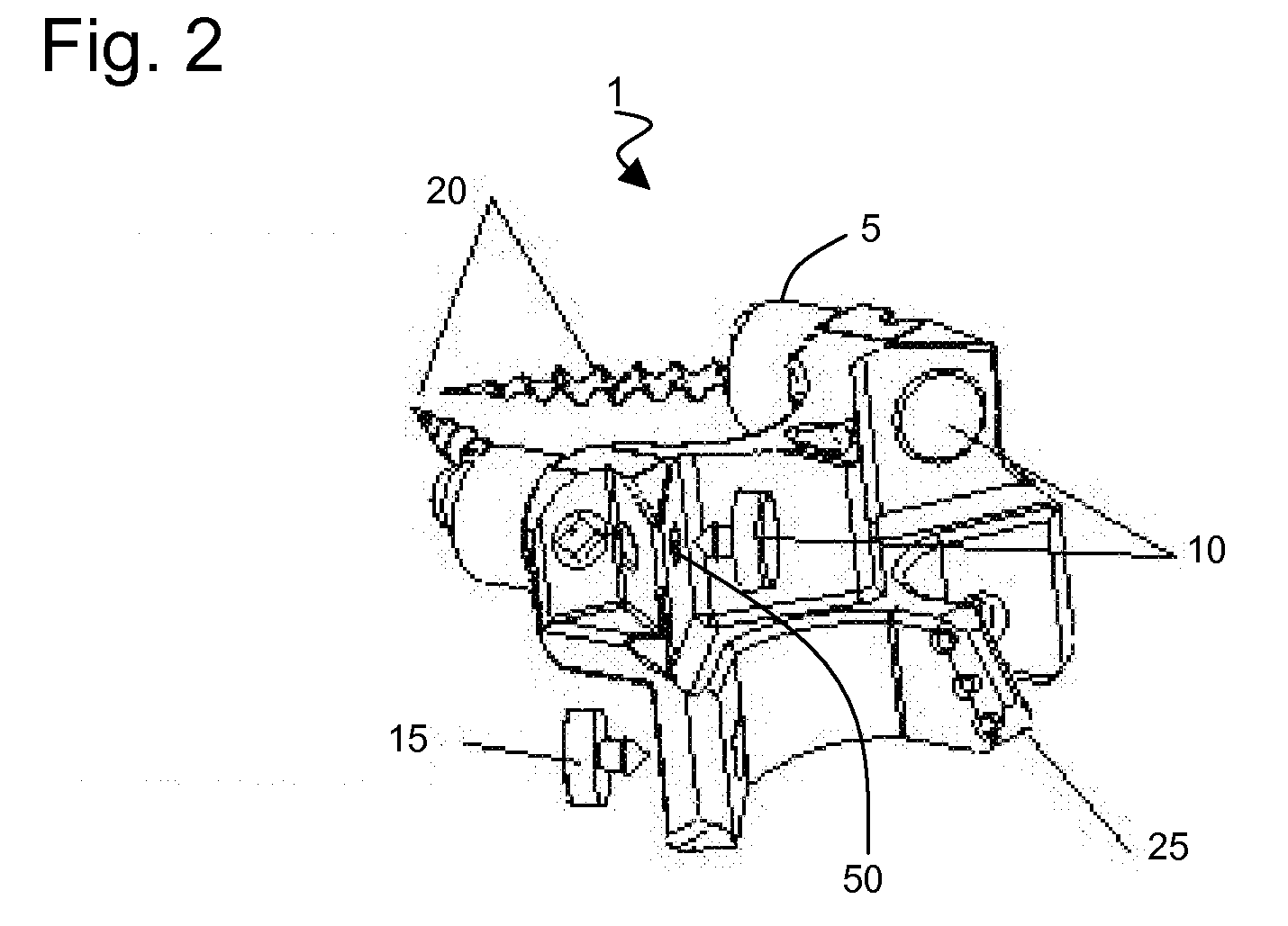 Prostheses for Spine Facets